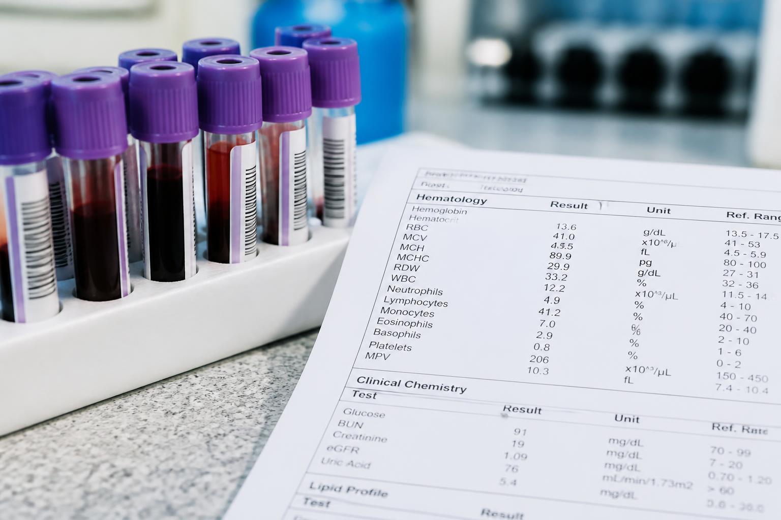 Iron Deficiency Anemia: Find the Cause, Not Just the Pill